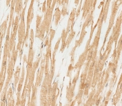 RNF4 Antibody / E3 Ubiquitin-Protein Ligase RNF4 Antibody. Immunohistochemistry analysis of RNF4 in FFPE human heart tissue. IHC staining of FFPE human heart using RNF4 Antibody / E3 Ubiquitin-Protein Ligase RNF4 Antibody demonstrates HRP-DAB brown staining within cardiomyocytes, with signal primarily localized to intracellular compartments consistent with nuclear and perinuclear distribution of this E3 ubiquitin ligase. The staining pattern reflects cellular regions associated with ubiquitin-mediated protein regulation and SUMO-targeted ubiquitination activity, while surrounding tissue architecture remains clearly defined.