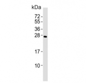 RNF4 Antibody / E3 Ubiquitin-Protein Ligase RNF4 Antibody for WB. Western blot analysis of RNF4 in human kidney tissue lysate. Lane 1: human kidney tissue lysate. A band is detected at approximately 28 kDa, consistent with the predicted molecular weight of E3 ubiquitin-protein ligase RNF4 (isoform 1). The observed signal aligns with expression of this nuclear E3 ubiquitin ligase, which functions in SUMO-targeted ubiquitination and regulation of protein degradation pathways.