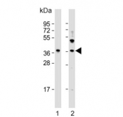 Western blot testing of human 1) PC-3 and 2) HepG2 cell lysate with LGASLS8 antibody. Expected molecular weight ~36/40 kDa (isoforms 1/2).