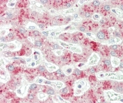 IHC testing of FFPE human liver tissue with PI3KC3 antibody. HIER: steam section in pH6 citrate buffer for 20 min and allow to cool prior to staining.