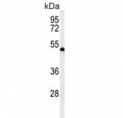 Western blot testing of 1) non-transfected and 2) transfected 293 cell lysate with RuvB-like 1 antibody.