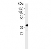 Western blot testing of human HeLa tissue lysate with TOPK antibody. Predicted molecular weight ~36 kDa.