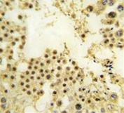 ZNF219 Antibody Human Testis IHC. Immunohistochemistry staining of FFPE human testis tissue with ZNF219 Antibody. HIER was performed by steaming tissue sections in pH 6 citrate buffer for 20 minutes, followed by cooling prior to staining. The section was incubated with ZNF219 antibody and developed using chromogenic detection. ZNF219 Antibody / Zinc Finger Transcription Factor Antibody demonstrates nuclear staining consistent with Zinc Finger Protein 219 expression and supports studies of DNA-binding proteins, transcriptional regulation and gene expression control pathways.