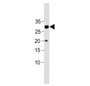 Western blot testing of human HuT-78 cell lysate with PRSS57 antibody. Predicted molecular weight ~30 kDa.