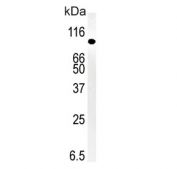 Western blot testing of mouse kidney tissue lysate with SMURF1 antibody. Expected molecular weight ~86 kDa.