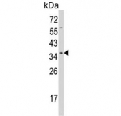 Western blot testing of human HeLa cell lysate with UNRIP antibody. Predicted molecular weight ~38 kDa.