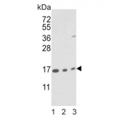 PPIA Antibody Human Mouse WB. Western blot analysis of 1) human T-47D, 2) mouse brain, and 3) mouse bladder lysates using PPIA Antibody demonstrates strong immunoreactive bands at approximately 18 kDa in all samples, consistent with the expected molecular weight of PPIA (Cyclophilin A). PPIA is a highly conserved peptidyl-prolyl cis-trans isomerase that functions as a molecular chaperone involved in protein folding, protein trafficking, and regulation of cellular stress response pathways. The consistent detection of endogenous PPIA across human and mouse tissues highlights its ubiquitous expression and supports the utility of this antibody for cross-species western blot applications. Predicted molecular weight: ~18 kDa. Observed molecular weight: ~18 kDa. A faint higher molecular weight band visible in the mouse bladder sample may represent a post-translationally modified form of PPIA, protein complex formation, or minor nonspecific reactivity.
