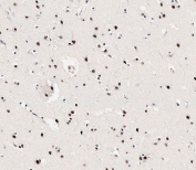 IHC testing of FFPE human brain tissue with phospho-MeCP2 antibody. HIER: steam section in pH9 EDTA for 20 min and allow to cool prior to staining.