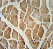 IHC testing of FFPE human skeletal muscle tissue with DAAM1 antibody. HIER: steam section in pH6 citrate buffer for 20 min and allow to cool prior to staining.