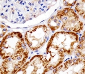 REDD-1 Antibody Human Kidney IHC. IHC staining of FFPE human kidney tissue with REDD-1 antibody demonstrated strong cytoplasmic staining of renal tubular epithelial cells, consistent with the expression pattern of REDD-1 (DDIT4), a stress-responsive regulator of mTOR signaling and cellular metabolism. REDD-1 is induced by hypoxia, oxidative stress, nutrient deprivation, and other cellular stressors, where it functions to suppress mTOR activity and promote adaptive survival responses. The prominent staining observed within renal tubules is consistent with the high metabolic activity of these cells and the importance of stress-response pathways in maintaining renal homeostasis. Heat-induced epitope retrieval was performed by steaming tissue sections in pH 6 citrate buffer for 20 minutes and allowing them to cool prior to staining. These results support the utility of REDD-1 Antibody for studies of hypoxia signaling, mTOR pathway regulation, cellular stress responses, and kidney biology.