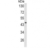 DCN Antibody WB. Western blot testing of mouse heart tissue lysate with DCN antibody. Predicted molecular weight ~40 kDa.