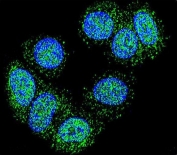 EEF1A1/2 Antibody Human MCF7 IF. Immunofluorescent staining of human MCF7 cells with EEF1A1/2 antibody revealed abundant cytoplasmic staining with a finely punctate distribution consistent with the localization of eukaryotic elongation factor 1 alpha proteins involved in protein synthesis and translational control. EEF1A1 and EEF1A2 are highly conserved GTP-binding proteins that mediate aminoacyl-tRNA delivery to ribosomes and additionally participate in cytoskeletal organization and cellular stress responses. Green fluorescence indicates EEF1A1/2 expression, while nuclei are counterstained with DAPI (blue). The widespread cytoplasmic staining pattern is consistent with the abundant expression of eEF1A proteins and their essential roles in maintaining cellular growth and metabolism. These results support the utility of EEF1A1/2 Antibody for studies of protein synthesis, cell proliferation, and cancer biology.