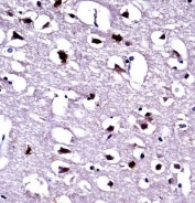 EEF1A1/2 Antibody Human Brain IHC. IHC staining of FFPE human brain tissue with EEF1A1/2 antibody demonstrated strong cytoplasmic staining of neuronal cell bodies, consistent with the expression pattern of eukaryotic elongation factor 1 alpha proteins involved in translational control and cellular homeostasis. EEF1A1 and EEF1A2 are highly conserved GTP-binding proteins that mediate aminoacyl-tRNA delivery during protein synthesis, with EEF1A2 being particularly enriched in neurons and muscle tissue. The prominent neuronal staining observed is consistent with the high metabolic demands and protein synthesis requirements of the central nervous system. Heat-induced epitope retrieval was performed by steaming tissue sections in pH 6 citrate buffer for 20 minutes and allowing them to cool prior to immunostaining. These results support the utility of EEF1A1/2 Antibody for studies of neurobiology, protein synthesis, and cellular metabolism.