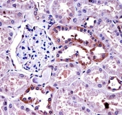 Immunohistochemistry of M-CSF antibody in human kidney tissue. FFPE human kidney was subjected to heat-induced epitope retrieval by steaming sections in pH 6 citrate buffer for 20 minutes followed by cooling prior to staining. M-CSF antibody demonstrates cytoplasmic HRP-DAB brown staining predominantly in renal tubular epithelial cells, with minimal staining in glomerular structures. The staining pattern is consistent with localized expression of Macrophage colony stimulating factor within tubular epithelium.