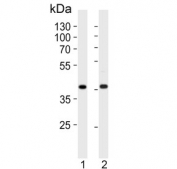 Calponin 1 Antibody HeLa and MDA-MB-453 WB. Western blot testing of human 1) HeLa and 2) MDA-MB-453 cell lysate with Calponin 1 antibody. Predicted molecular weight ~33 kDa.