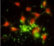 Immunofluorescent staining of human HeLa cells with SRP72 antibody (green) and propidium iodide (nuclear, red).