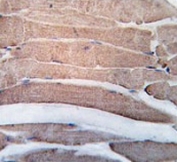 Death-associated Protein Kinase 2 Antibody Human Skeletal Muscle IHC. Immunohistochemistry staining of FFPE human skeletal muscle tissue using Death-associated protein kinase 2 antibody demonstrates diffuse cytoplasmic staining throughout skeletal myofibers, consistent with expression of Death Associated Protein Kinase 2 (DAPK2). DAPK2 is a calcium/calmodulin-regulated serine/threonine kinase that participates in signaling pathways involved in cellular stress responses, apoptosis regulation, autophagy, and maintenance of tissue homeostasis. The observed staining pattern is consistent with the intracellular localization expected for a signaling kinase and supports the utility of this antibody for studies of kinase-mediated regulatory pathways in muscle biology and cellular adaptation. HIER: steam section in pH6 citrate buffer for 20 min and allow to cool prior to staining.