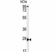 Western blot testing of human HL60 cell lysate with DPT antibody. Expected molecular weight: 22-24 kDa.