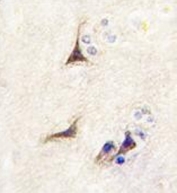 Beta-Nerve Growth Factor Antibody Human Brain IHC. Immunohistochemistry analysis of FFPE human brain tissue using Beta-Nerve Growth Factor Antibody / Neurotrophic Signaling Antibody. Neuronal cells demonstrate HRP-DAB brown cytoplasmic staining consistent with beta-NGF / mature Nerve growth factor expression in neural tissue, while nuclei are counterstained blue. HIER was performed by steaming tissue sections in pH6 citrate buffer for 20 minutes followed by cooling prior to staining.
