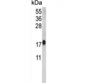 Western blot testing of human HeLa cell lysate with CALM1 antibody. Predicted molecular weight ~17 kDa.