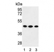 Western blot testing of human 1) K562, 2) HEK293 and 3) MDA-MB-231 cell lysate with GPA33 antibody. Expected molecular weight: 33-43 kDa depending on glycosylation level.