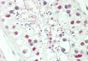 HOXA3 Antibody Human Testis IHC. IHC staining of FFPE human testis tissue with HOXA3 antibody demonstrated predominantly nuclear staining in germ cells within the seminiferous tubules, consistent with the localization of HOXA3 as a homeobox transcription factor that regulates developmental gene expression and cellular differentiation. Although HOXA3 is best known for its essential role in embryonic patterning and organogenesis, continued expression in adult reproductive tissues supports functions in germ cell development, tissue homeostasis, and reproductive biology. The nuclear staining pattern is consistent with the transcriptional regulatory activity of HOXA3. HIER was performed by steaming tissue sections in pH 6 citrate buffer for 20 minutes followed by cooling prior to staining. These results support the utility of HOXA3 Antibody for studies of developmental biology, reproductive biology, transcriptional regulation, and stem cell function.