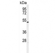 HOXA3 Antibody Human HL60 WB. Western blot analysis of HOXA3 expression was performed using anti-HOXA3 antibody in human HL60 cell lysate. HOXA3 is a homeobox transcription factor that regulates developmental gene expression, embryonic patterning, tissue specification, and cellular differentiation during vertebrate development. A specific immunoreactive band is detected at approximately 46 kDa, consistent with the predicted molecular weight of HOXA3. Expression in HL60 promyelocytic leukemia cells is consistent with the recognized involvement of HOXA3 in hematopoietic development and the dysregulation of HOX transcription factors in leukemia. These results support the utility of HOXA3 Antibody for studies of developmental transcriptional regulation, hematopoiesis, stem cell biology, and cancer research.
