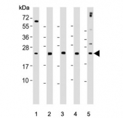Western blot testing of human 1) WiDr, 2) Raji, 3) K562, 4) Jurkat and 5) CCRF-CEM cell lysate with CTLA4 antibody. Predicted molecular weight ~25 kDa but may be observed at higher molecular weights due to glycosylation.