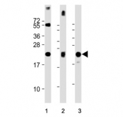 Western blot testing of 1) human lung, 2) mouse lung and 3) rat lung tissue lysate with SFTPC antibody. Predicted molecular weight ~21 kDa.