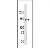Western blot testing of mouse liver tissue lysate with CrkRS antibody. Predicted molecular weight ~164 kDa.