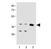 Cx40 Antibody Human and Mouse WB. Western blot analysis of human Jurkat and HepG2 cell lysates together with mouse brain tissue lysate using Cx40 antibody demonstrates detection of a prominent immunoreactive band at approximately 40 kDa, consistent with the expected molecular weight of Connexin 40 (Cx40/GJA5). Cx40 is a gap junction protein that forms intercellular channels enabling the direct exchange of ions and signaling molecules between neighboring cells. The observed expression across both human and mouse samples supports the utility of this antibody for studies of gap junction biology, intercellular communication, cardiovascular signaling, and connexin-mediated cellular regulation. Predicted molecular weight: ~40 kDa.