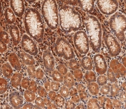 Cx40 Antibody Human Stomach IHC. Immunohistochemistry staining of FFPE human stomach tissue using Cx40 antibody demonstrates widespread cytoplasmic and membranous staining throughout gastric epithelial cell populations, consistent with expression of Connexin 40 (Cx40/GJA5). Cx40 is a gap junction protein that forms intercellular channels facilitating the direct exchange of ions, metabolites, and signaling molecules between neighboring cells. The observed staining pattern is consistent with the role of connexin proteins in coordinating cell-to-cell communication, maintaining tissue organization, and supporting physiologic homeostasis within epithelial tissues. These findings support the utility of Cx40 antibody for studies of gap junction biology, intercellular communication, and connexin-mediated signaling pathways. HIER: steam section in pH9 EDTA buffer for 20 min and allow to cool prior to staining.