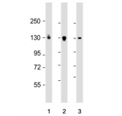 Western blot testing of human 1) HL60, 2) KG-1 and 3) U-87 MG cell lysate with DEPDC5 antibody. Predicted molecular weight: 131-188 kDa and ~64 kDa (eight isoforms).