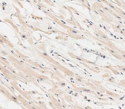 IHC staining of FFPE human heart tissue with MARCH5 antibody. HIER: steam section in pH6 citrate buffer for 20 min and allow to cool prior to staining.