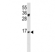 IgJ Antibody Mouse Spleen WB. Western blot analysis of mouse spleen tissue lysate using IgJ antibody detects a band near approximately 18 kDa, consistent with the predicted molecular weight of JCHAIN / IGJ, an immunoglobulin-associated protein involved in plasma cell differentiation and polymeric antibody assembly.