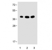 Western blot testing of 1) human liver, 2) mouse liver and 3) rat liver tissue lysate with Ornithine transcarbamylase antibody. Predicted molecular weight ~40 kDa.