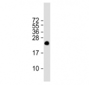 Western blot testing of human MOLT-4 cell lysate with ORMDL3 antibody. Predicted molecular weight ~17 kDa.