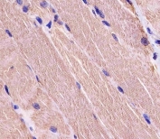 IHC staining of FFPE human skeletal muscle tissue with Myosin-binding protein C antibody. HIER: steam section in pH6 citrate buffer for 20 min and allow to cool prior to staining.