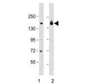 Western blot testing of 1) mouse heart and 2) rat heart tissue lysate with Myosin-binding protein C antibody. Predicted molecular weight ~141 kDa.