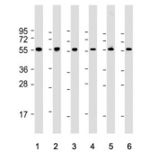 MAPE Antibody WB. Western blot testing of human 1) HeLa, 2) K562, 3) HEK293, 4) testis, 5) brain and 6) kidney tissue lysate with MAPE antibody. Predicted molecular weight ~58 kDa.