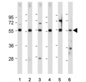 FOXD1 Antibody Human and Mouse WB. Western blot analysis of human HEK293, U-2 OS, U-87 MG, and Y79 cell lysates, as well as mouse kidney and mouse eyeball tissue lysates, using FOXD1 antibody demonstrates detection of a prominent immunoreactive band at approximately 46-55 kDa, consistent with expression of Forkhead Box Protein D1 (FOXD1). FOXD1 is a developmental transcription factor that regulates gene expression programs involved in tissue patterning, cellular differentiation, and organogenesis. The observed expression across both cultured cell lines and mouse tissues is consistent with the role of FOXD1 in developmental regulatory networks and maintenance of tissue-specific gene expression programs. Predicted molecular weight: ~46 kDa.