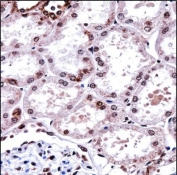 FOXD1 Antibody Human Kidney IHC. Immunohistochemistry staining of FFPE human kidney tissue using FOXD1 antibody demonstrates prominent nuclear staining within renal tubular epithelial cells, consistent with expression of Forkhead Box Protein D1 (FOXD1). FOXD1 is a developmental transcription factor that regulates gene expression programs involved in tissue patterning, cellular differentiation, and maintenance of specialized cellular identities. The observed nuclear localization is consistent with the role of FOXD1 as a DNA-binding transcriptional regulator and supports its involvement in developmental and tissue-specific regulatory pathways within the kidney. HIER: steam section in pH6 citrate buffer for 20 min and allow to cool prior to staining.