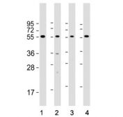 Western blot testing of human 1) 293T, 2) Ramos, 3) Raji and 4) Daudi cell lysate with FCRL4 antibody. Predicted molecular weight ~57 kDa.