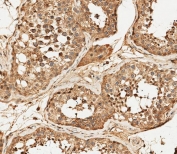 IHC staining of FFPE human testis tissue with PFKFB4 antibody. HIER: steam section in pH6 citrate buffer for 20 min and allow to cool prior to staining.