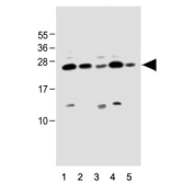 Western blot testing of human 1) HaCaT, 2) U-2 OS, 3) MCF7, 4) T-47D and 5) PC-3 cell lysate with SCXA antibody. Predicted molecular weight ~22 kDa.
