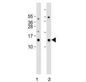 Western blot testing of human 1) heart and 2) kidney tissue lysate with MT-ND3 antibody. Predicted molecular weight ~13 kDa.