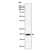 Western blot analysis of UFC1 expression in cell lysate using UFC1 antibody. Predicted molecular weight ~19 kDa.