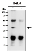 Immunoprecipitate (IP) analysis using the antibody at 1:50 dilution. Western blot at 1:1K dilution. Predicted molecular weight ~34 kDa. A band is detected at approximately 38-39 kDa in the IP lane, slightly above the predicted ~34 kDa size. This upward shift is consistent with altered migration of immunoprecipitated material, which often reflects partial complex retention or antibody related artifacts rather than a distinct isoform. The control IgG lane shows no corresponding band, confirming specificity of the immunoprecipitation.