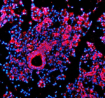 IF analysis of TMED10 using anti-TMED10 antibody (red). TMED10 was detected in a paraffin-embedded section of human parotid gland tissue. Heat mediated antigen retrieval was performed in EDTA buffer (pH 8.0, epitope retrieval solution). The tissue section was blocked with 10% goat serum. The tissue section was then incubated with 5 ug/ml rabbit anti-TMED10 antibody overnight at 4oC. Cy3 Conjugated Goat Anti-Rabbit IgG was used as secondary antibody at 1:500 dilution and incubated for 30 minutes at 37oC. The section was counterstained with DAPI (blue). Visualize using a fluorescence microscope and filter sets appropriate for the label used.