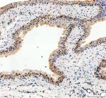 NEK7 Antibody Rat Bladder IHC. Immunohistochemistry staining of FFPE rat bladder tissue with NEK7 Antibody at 2 ug/ml. HIER was performed using pH 8 EDTA buffer, followed by blocking with 10% goat serum. The tissue section was incubated with rabbit anti-NEK7 antibody overnight at 4Â°C, followed by HRP-conjugated goat anti-rabbit IgG secondary antibody and DAB chromogen detection. NEK7 Antibody / Inflammasome Activation Protein Antibody demonstrates staining consistent with NIMA Related Kinase 7 expression and supports studies of NLRP3 inflammasome activation, innate immune signaling and inflammatory pathway regulation.